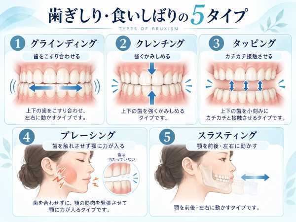 bruxism_5_types